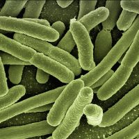 koli bacteria, escherichia coli, bacteria, disease, pathogens, microscopy, electron microscopy, electron microscope, vaccination, immune system, diseases, vaccine, escherichia, infect, infection, risk of infection, pathogen, viruses, bacteria, bacteria, bacteria, bacteria, bacteria